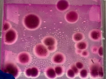 Aspergillus mould