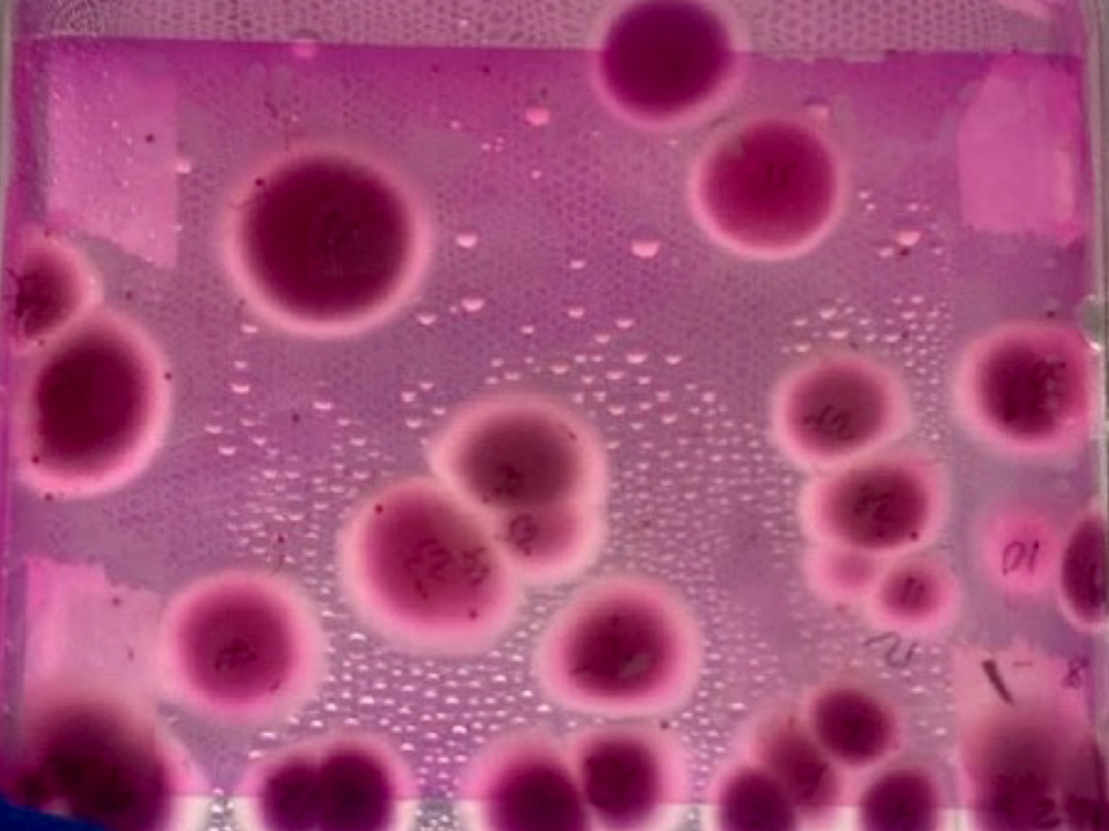 Aspergillus mould